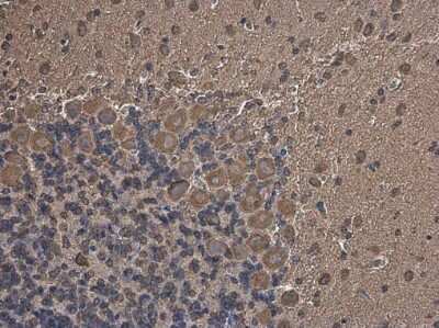 Immunohistochemistry-Paraffin: Methionyl tRNA synthetase Antibody [NBP3-13217]