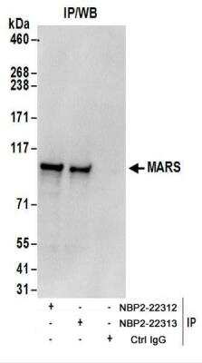 Immunoprecipitation: Methionyl tRNA synthetase Antibody [NBP2-22312]