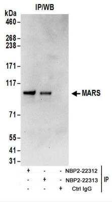 Immunoprecipitation: Methionyl tRNA synthetase Antibody [NBP2-22313]