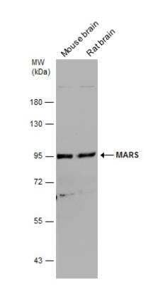 Western Blot: Methionyl tRNA synthetase Antibody [NBP1-33016]