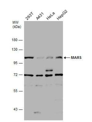 Western Blot: Methionyl tRNA synthetase Antibody [NBP1-33016]