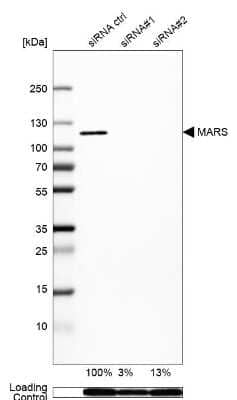 Western Blot: Methionyl tRNA synthetase Antibody [NBP1-87730]