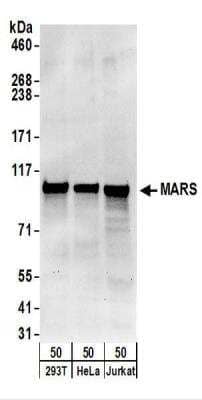 Western Blot: Methionyl tRNA synthetase Antibody [NBP2-22312]