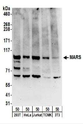 Western Blot: Methionyl tRNA synthetase Antibody [NBP2-22313]