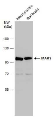 Western Blot: Methionyl tRNA synthetase Antibody [NBP3-13217]