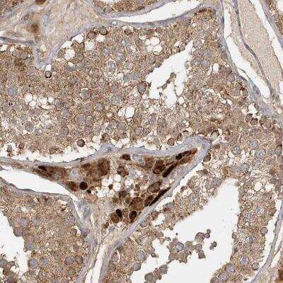 Immunohistochemistry: Methylmalonyl Coenzyme A mutase Antibody [NBP2-34024]