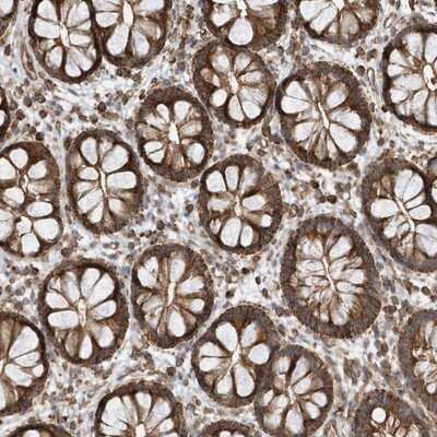 Immunohistochemistry-Paraffin: Methylmalonyl Coenzyme A mutase Antibody [NBP1-87423]