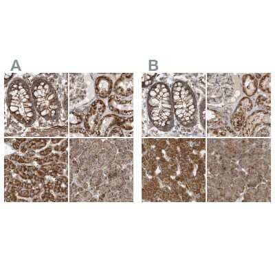 Immunohistochemistry-Paraffin: Methylmalonyl Coenzyme A mutase Antibody [NBP1-87423]