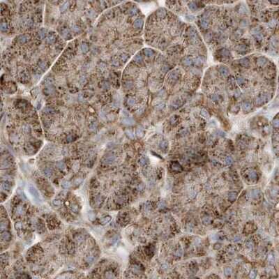 Immunohistochemistry-Paraffin: Methylmalonyl Coenzyme A mutase Antibody [NBP1-87423]