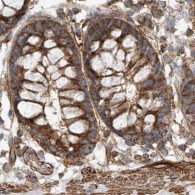 Immunohistochemistry-Paraffin: Methylmalonyl Coenzyme A mutase Antibody [NBP1-87423]