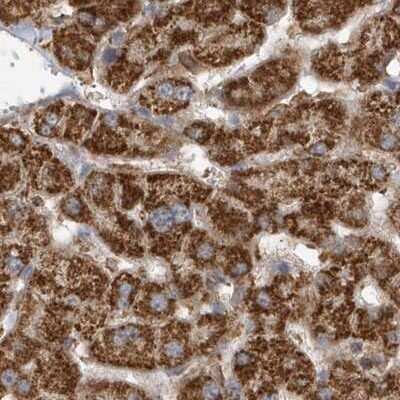 Immunohistochemistry-Paraffin: Methylmalonyl Coenzyme A mutase Antibody [NBP1-87423]