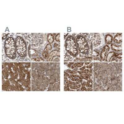 Immunohistochemistry-Paraffin: Methylmalonyl Coenzyme A mutase Antibody [NBP2-34024]