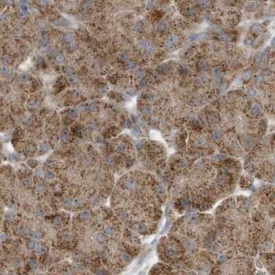 Immunohistochemistry-Paraffin: Methylmalonyl Coenzyme A mutase Antibody [NBP2-34024]