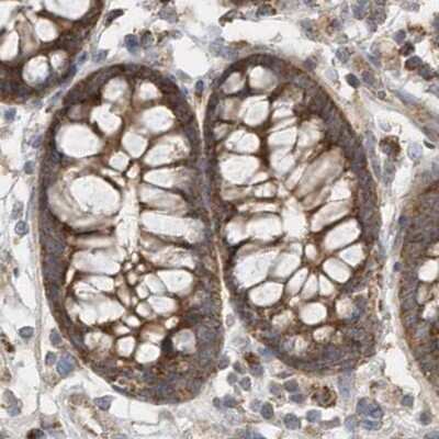 Immunohistochemistry-Paraffin: Methylmalonyl Coenzyme A mutase Antibody [NBP2-34024]