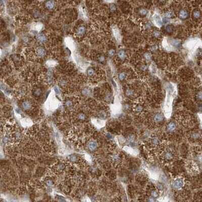 Immunohistochemistry-Paraffin: Methylmalonyl Coenzyme A mutase Antibody [NBP2-34024]