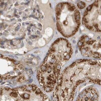Immunohistochemistry-Paraffin: Methylmalonyl Coenzyme A mutase Antibody [NBP2-34024]
