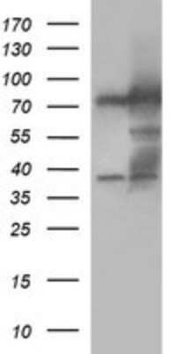 Western Blot: Methylmalonyl Coenzyme A mutase Antibody (OTI2C8)Azide and BSA Free [NBP2-72652]