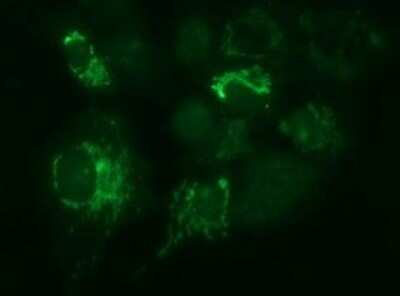 Immunofluorescence: Methylmalonyl Coenzyme A mutase Antibody (OTI2C8) [NBP2-46053]