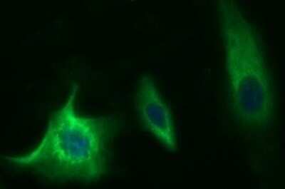 Immunofluorescence: Methylmalonyl Coenzyme A mutase Antibody (OTI2C8) [NBP2-46053]