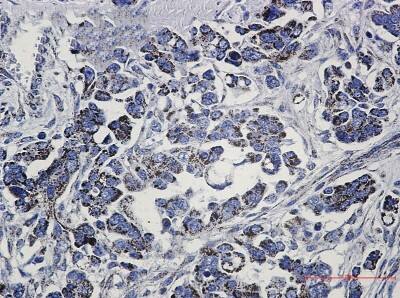Immunohistochemistry-Paraffin: Methylmalonyl Coenzyme A mutase Antibody (S05-3G4) [NBP3-19689]