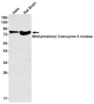 Western Blot: Methylmalonyl Coenzyme A mutase Antibody (S05-3G4) [NBP3-19689]