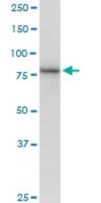 Western Blot: Methylmalonyl Coenzyme A mutase Antibody [H00004594-B01P]