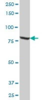 Western Blot: Methylmalonyl Coenzyme A mutase Antibody [H00004594-B01P]