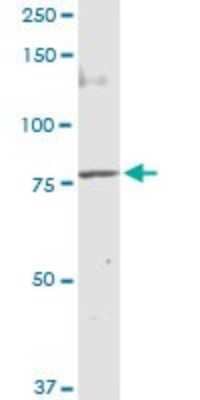 Western Blot: Methylmalonyl Coenzyme A mutase Antibody [H00004594-D01P]