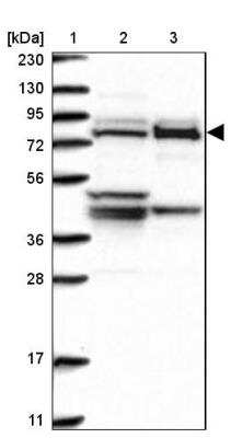 Western Blot: Methylmalonyl Coenzyme A mutase Antibody [NBP1-87423]