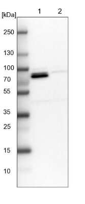 Western Blot: Methylmalonyl Coenzyme A mutase Antibody [NBP1-87423]