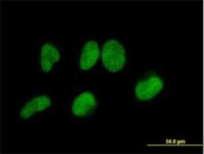 Immunocytochemistry/ Immunofluorescence: Methyltransferase like 3 Antibody [H00056339-B01P]