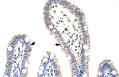 Immunohistochemistry: Methyltransferase like 3 Antibody [NBP2-82284]