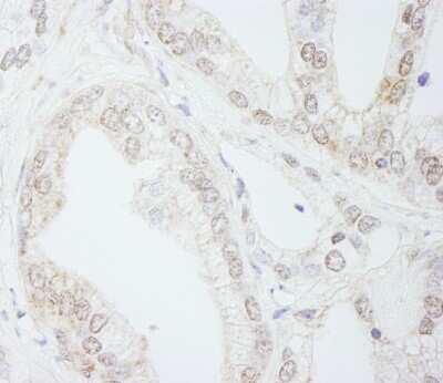 Immunohistochemistry-Paraffin: Methyltransferase like 3 Antibody [NB100-77311]