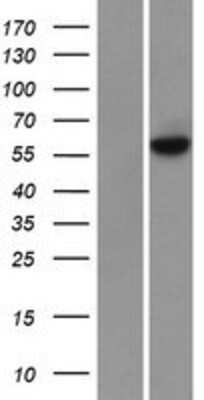 Western Blot: Methyltransferase like 3 Overexpression Lysate [NBP2-06710]