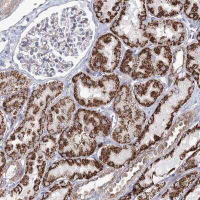 Immunohistochemistry-Paraffin: Methyltransferase like 5 Antibody [NBP1-92107]