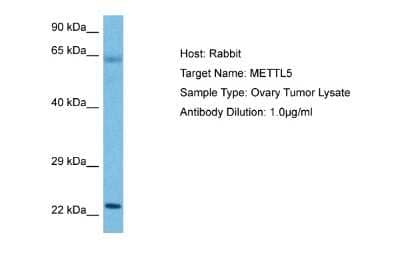 Western Blot: Methyltransferase like 5 Antibody [NBP2-87801]