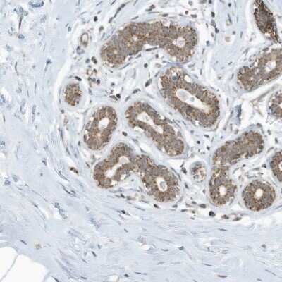 Immunohistochemistry-Paraffin: Methyltransferase like 6 Antibody [NBP1-92108]