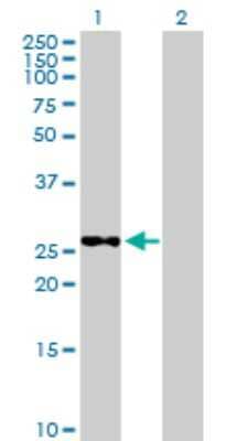 Western Blot: Methyltransferase like 6 Antibody [H00131965-B01P]