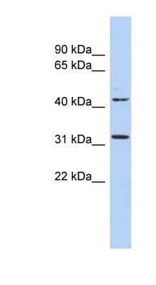 Western Blot: Methyltransferase like 6 Antibody [NBP1-55179]