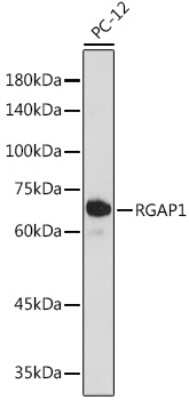 Western Blot: MgcRacGAP/RACGAP1 Antibody (10F7U6) [NBP3-15700]
