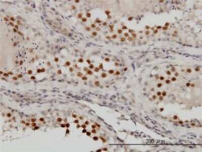 Immunohistochemistry-Paraffin: MgcRacGAP/RACGAP1 Antibody (1G6) [H00029127-M01]