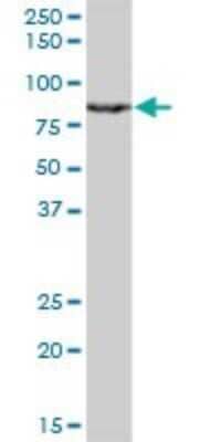 Western Blot: MgcRacGAP/RACGAP1 Antibody (1G6) [H00029127-M01]