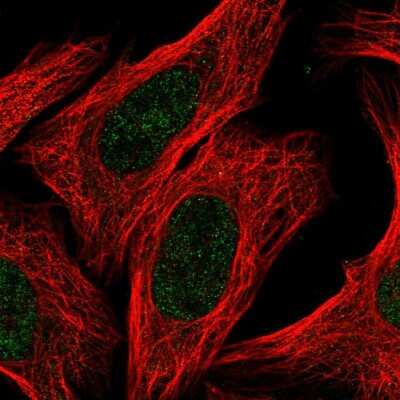 Immunocytochemistry/ Immunofluorescence: MgcRacGAP/RACGAP1 Antibody [NBP2-55429]