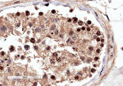 Immunohistochemistry-Paraffin: MgcRacGAP/RACGAP1 Antibody [NB100-884]