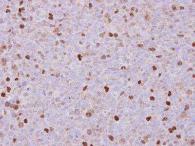 Immunohistochemistry-Paraffin: MgcRacGAP/RACGAP1 Antibody [NBP1-33455]