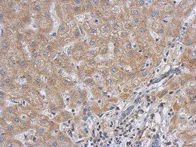 Immunohistochemistry-Paraffin: MgcRacGAP/RACGAP1 Antibody [NBP1-33455]