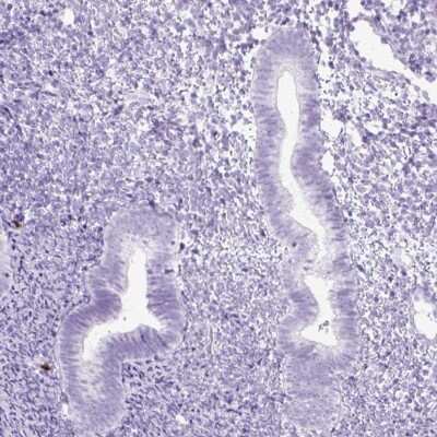 Immunohistochemistry-Paraffin: MgcRacGAP/RACGAP1 Antibody [NBP2-47374]