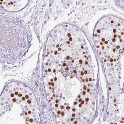 Immunohistochemistry-Paraffin: MgcRacGAP/RACGAP1 Antibody [NBP2-47374]