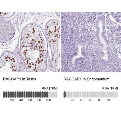 Immunohistochemistry-Paraffin: MgcRacGAP/RACGAP1 Antibody [NBP2-47374]