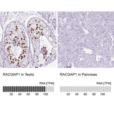 Immunohistochemistry-Paraffin: MgcRacGAP/RACGAP1 Antibody [NBP2-47374]